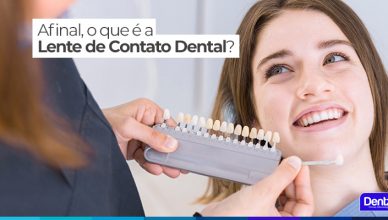 Afinal, o que é a Lente de Contato Dental?